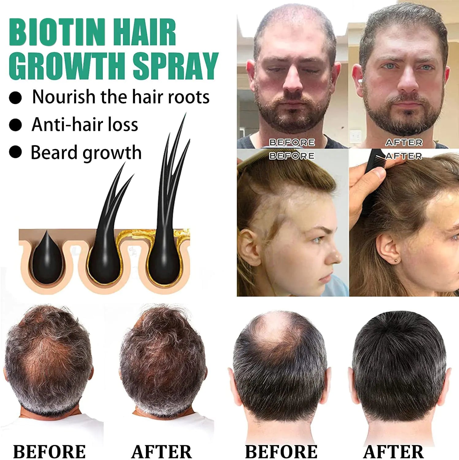 Biotin Hair Revitalizer